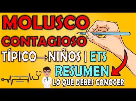 como eliminar molusco contagioso naturalmente|Remedios caseros eficaces para el molusco contagioso:。